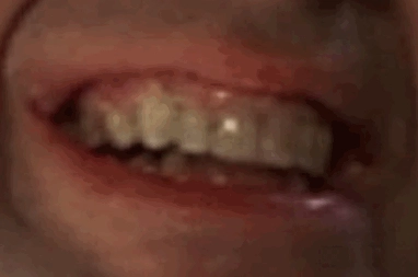 flickerteeth